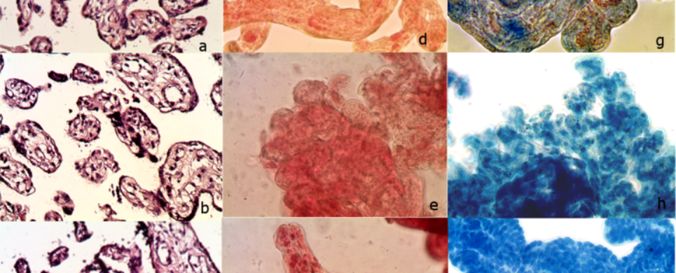 Coloured microscopic slices of placental tissue